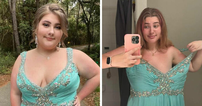 Before and after major weight loss transformation, woman showing results of blood sweat tears and Ozempic use in a turquoise dress