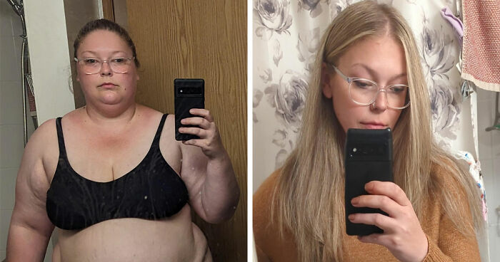 Before and after major weight loss transformation using Ozempic, with noticeable changes in body size and appearance.