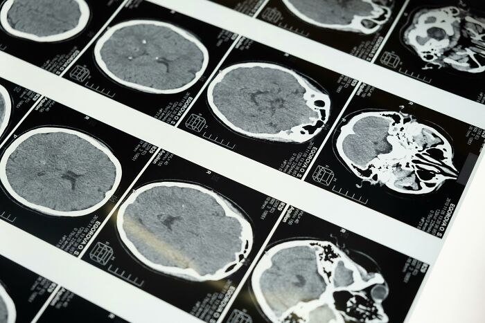 Close-up of brain scan images showing detailed MRI cross-sections related to fictional things people still believe in.
