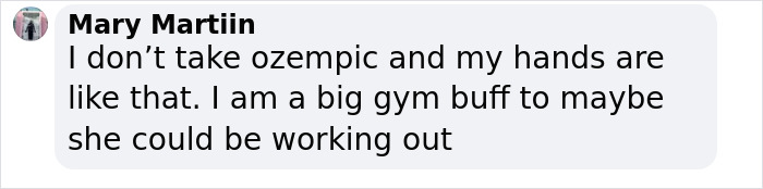 Screenshot of a social media comment discussing Ozempic hands side effect and personal experience with hand appearance.