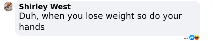 Comment about weight loss and hands in a social media post mentioning Ozempic hands side effect.