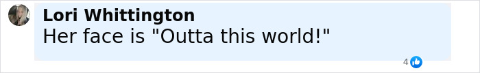 Comment by Lori Whittington saying her face is Outta this world in a social media post discussing blue veins on her hands.