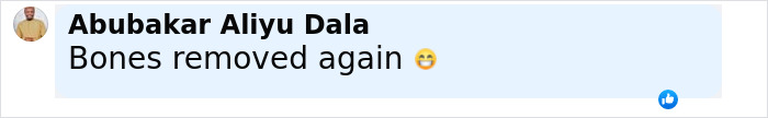 Screenshot of a comment stating bones removed again with a smiling emoji, related to Kim Kardashian's tiny waist and ribs theory.