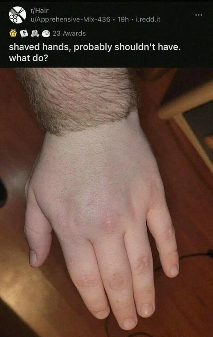 Hand with contrasting shaved and unshaved areas showing unusual hair pattern, a curious sight that makes people go hmmm.