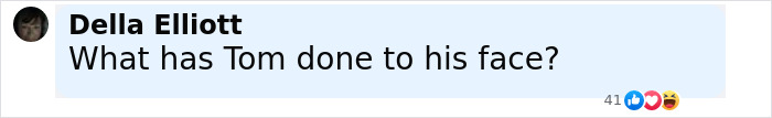 Comment on social media questioning Tom Cruise's face, sparking Botox rumors after F1 premiere with Brad Pitt.