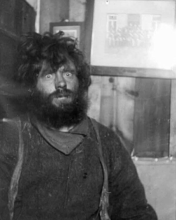 Hombre con aspecto desaliñado y barba espesa, mostrando un lado distinto de la historia en fotografía antigua.