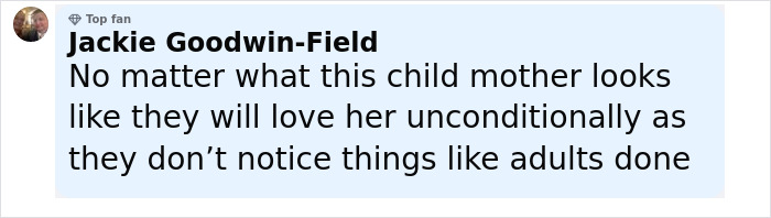 Comment from a top fan expressing unconditional love for a mom with a rare skin condition despite online criticism.