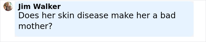 Comment from Jim Walker asking if her skin disease makes her a bad mother in a social media post.