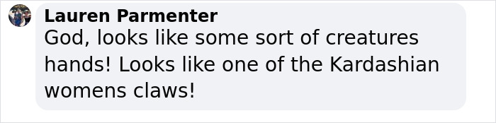 User comment on social media about hands resembling Kardashian claws, linked to Ozempic hands side effect warning.