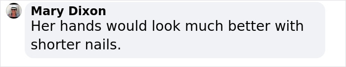 Comment on a social media post, discussing appearance of hands possibly related to Ozempic hands side effect warnings.