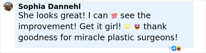 Woman's facelift reaction comment praising improvement and thanking plastic surgeons for the transformation and results.