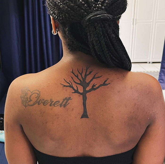 Person with poison tree tattoo on upper back, featuring a barren tree design in black ink. Person with poison tree tattoo on upper back, featuring a barren tree design in black ink.