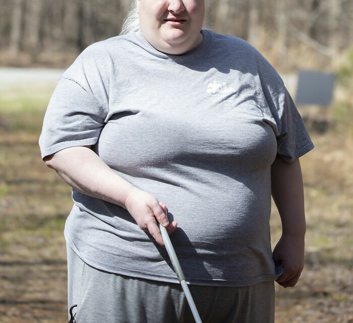 Overweight person outdoors holding a white cane, related to doctors sharing shocking discoveries made during autopsies.