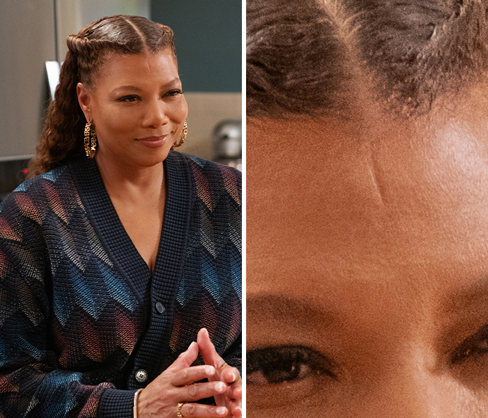 Celebrity displaying a subtle body anomaly on the forehead, captured in a close-up and mid-shot portrait.