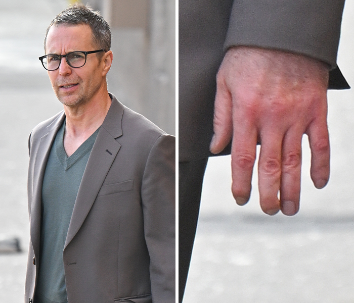Man in glasses and blazer showing unusual finger anomaly, highlighting bizarre celebrity body anomalies that left fans speechless.