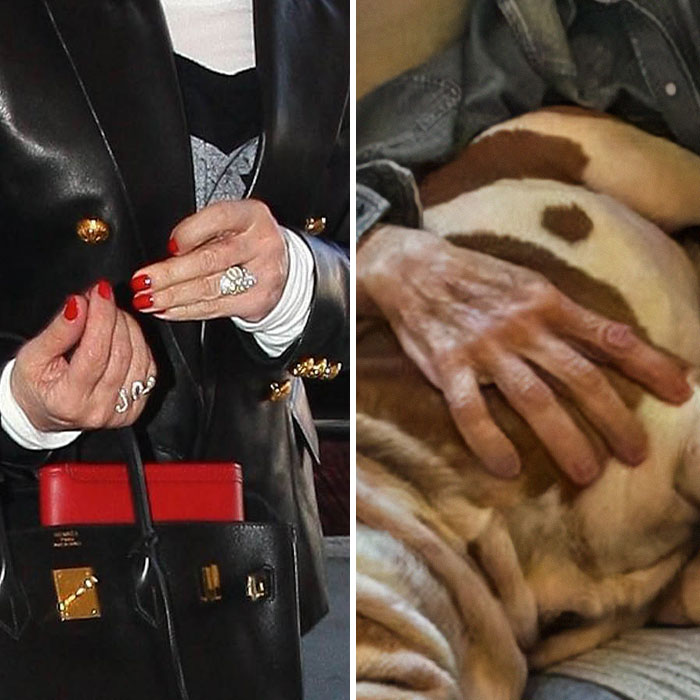 “Ozempic Hands” Is The Latest Skinny Side Effect No One Asked For: “Excuse Me While I Throw Up”