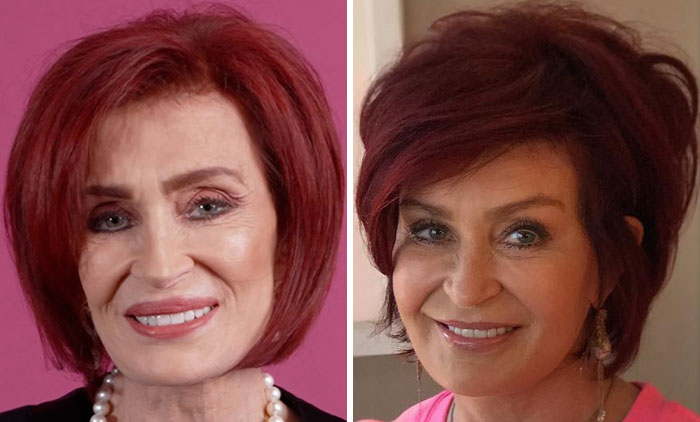 Nicole Scherzinger with red hair showing a drastic transformation, highlighting possible Ozempic side effect as noted by doctors.