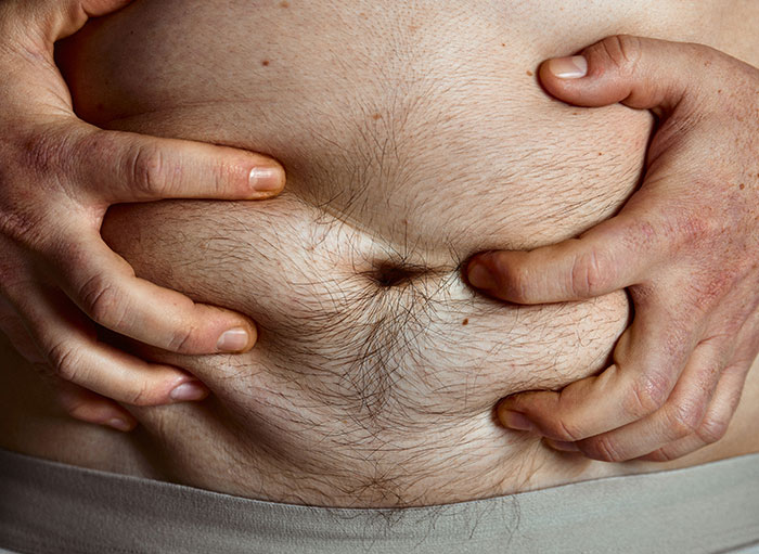 Close-up of hands squeezing abdominal skin showing unusual details of the human body as shared by surgeons