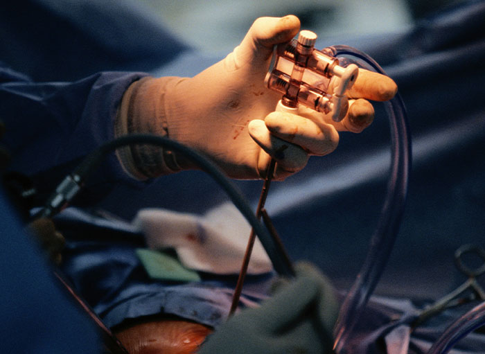 Surgeon’s gloved hand holding surgical tool during an operation revealing weird facts about the human body.