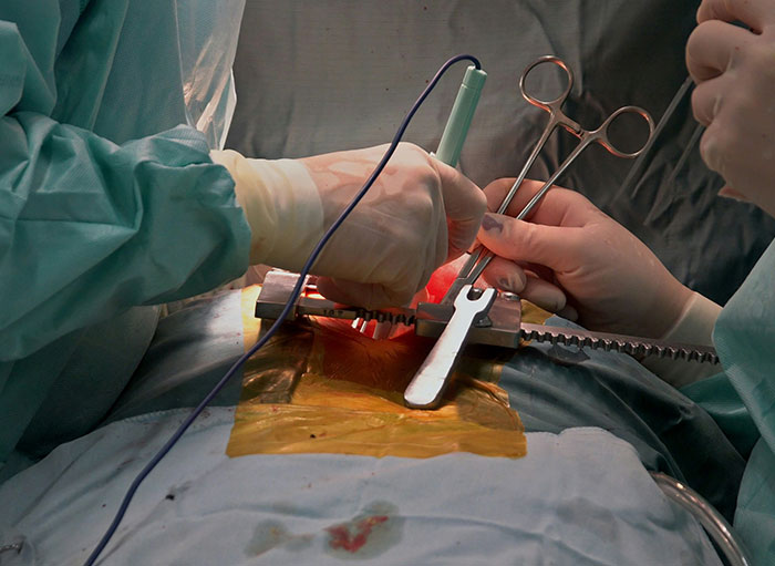 Surgeons performing delicate surgery, showcasing intricate aspects of the human body and medical instruments in use.