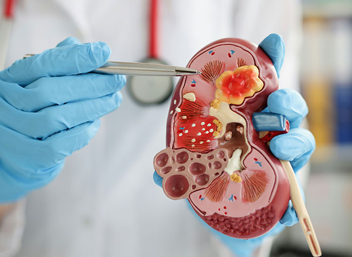 Medical professional wearing blue gloves pointing at a detailed human body kidney model with a metal pen.