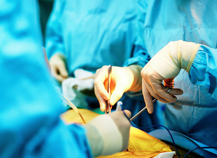 Surgeons in blue scrubs performing surgery, highlighting unusual facts about the human body during operation.