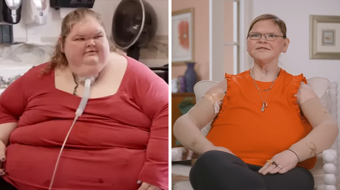 Before and after images showing shocking transformation of 1000-lb sisters star following 8-hour surgery recovery. Before and after images showing shocking transformation of 1000-lb sisters star following 8-hour surgery recovery.