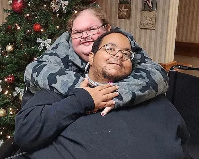Two people hugging in a living room beside a Christmas tree, highlighting shocking transformation after 8-hour surgery. Two people hugging in a living room beside a Christmas tree, highlighting shocking transformation after 8-hour surgery.