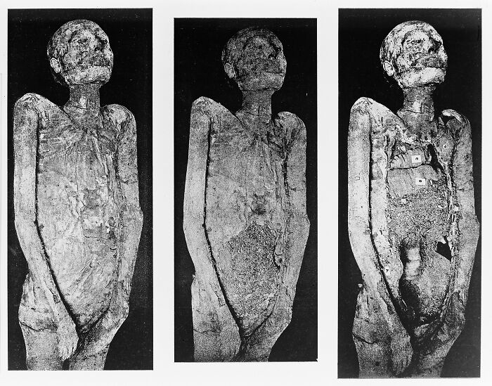 Three black and white photos of a decomposed mummy, showcasing creepy and unsettling details from the past.