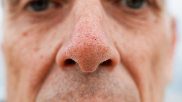 Close-up of an older man's face showing skin texture and pores, highlighting unique features related to genes.