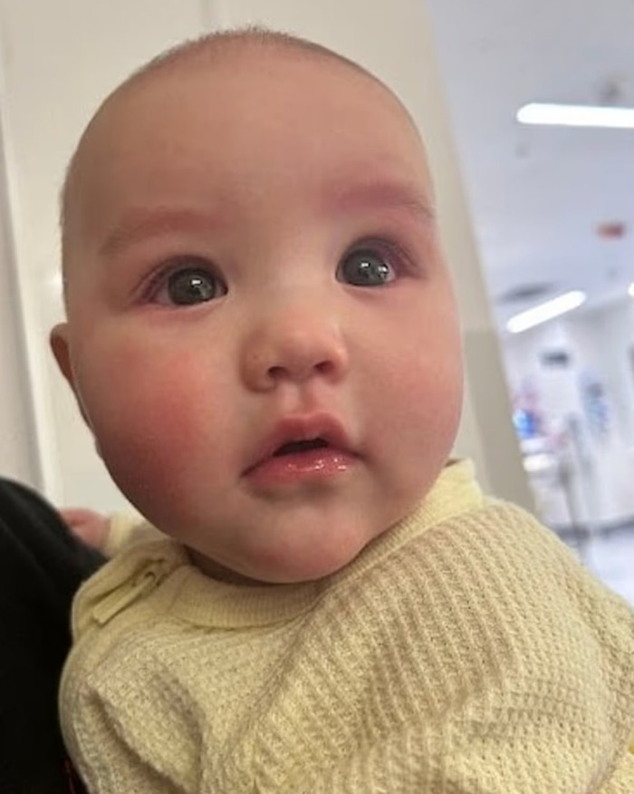 Close-up of a 5-month-old baby with a swollen eye, appearing concerned in a hospital setting after a fire extinguisher prank incident.