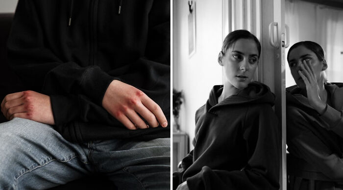 Person with bruised hands in a black hoodie and woman looking at her reflection, illustrating a truth or dare poll scenario.