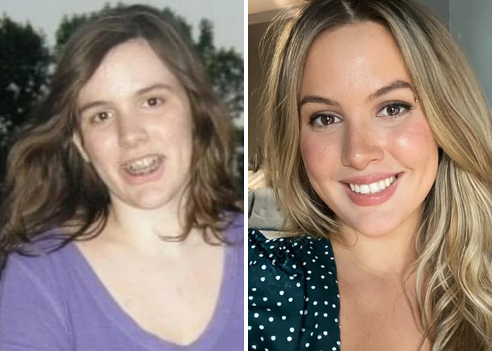 Before and after photos of a woman showing an inspiring ugly duckling glow-up transformation with noticeable confidence and style.