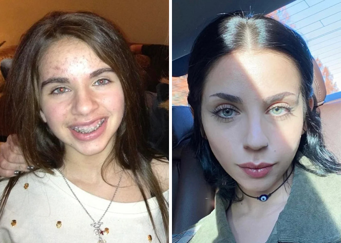 Side-by-side photos showing an inspiring ugly ducklings glow-up with clear skin and styled hair transformation.