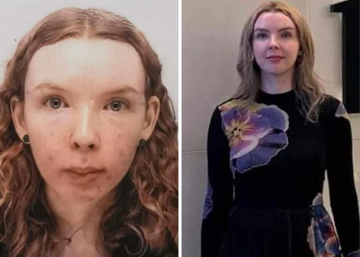 Before and after photos showing a dramatic glow-up transformation of an inspiring ugly duckling.