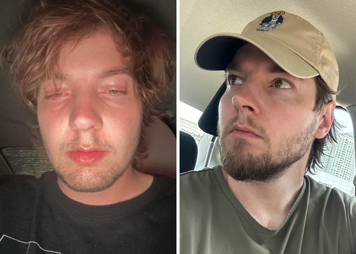 Side-by-side photos showing an inspiring glow-up transformation of a young man, highlighting ugly ducklings change.