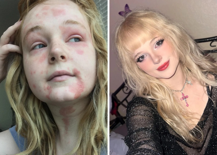 Side-by-side before and after photos showing an inspiring ugly ducklings glow-up transformation.