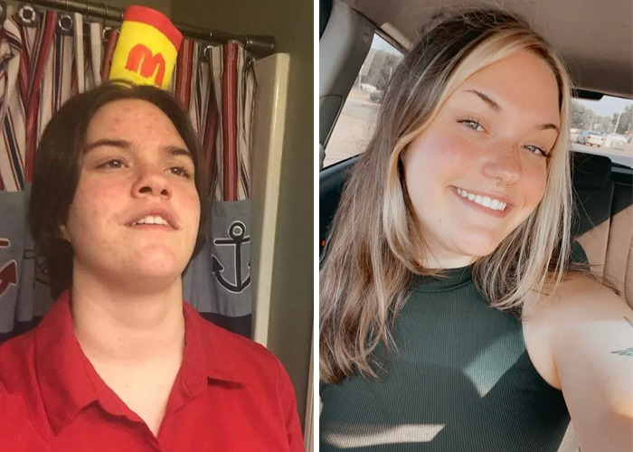 Side-by-side glow-up photos showing a young woman’s inspiring ugly duckling transformation and confident smile.