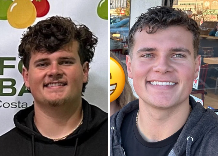 Side-by-side before and after photos showing an inspiring glow-up transformation of an ugly duckling.