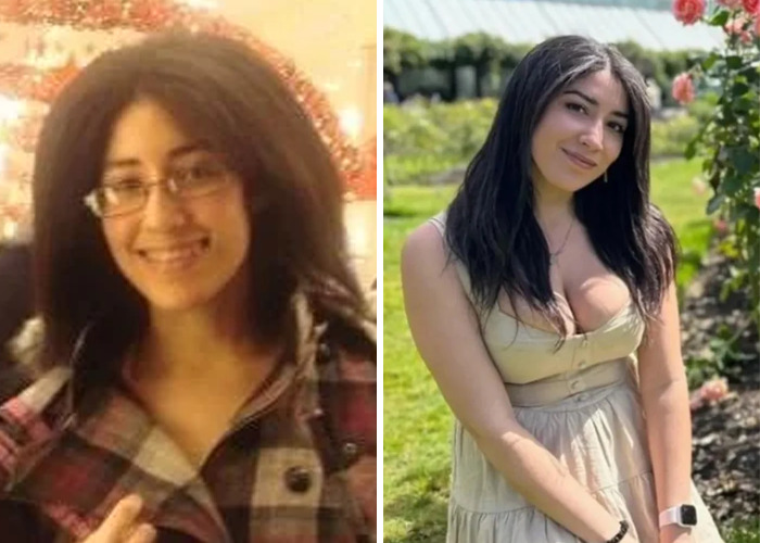 Before and after glow-up photos of a young woman showcasing an inspiring ugly duckling transformation outdoors.