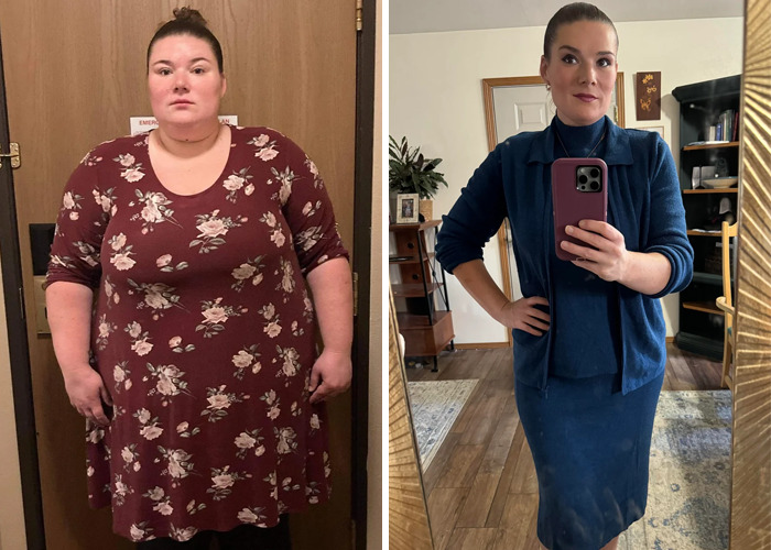 Before and after photos of a woman showing inspiring ugly ducklings glow-ups with noticeable weight loss and style transformation.