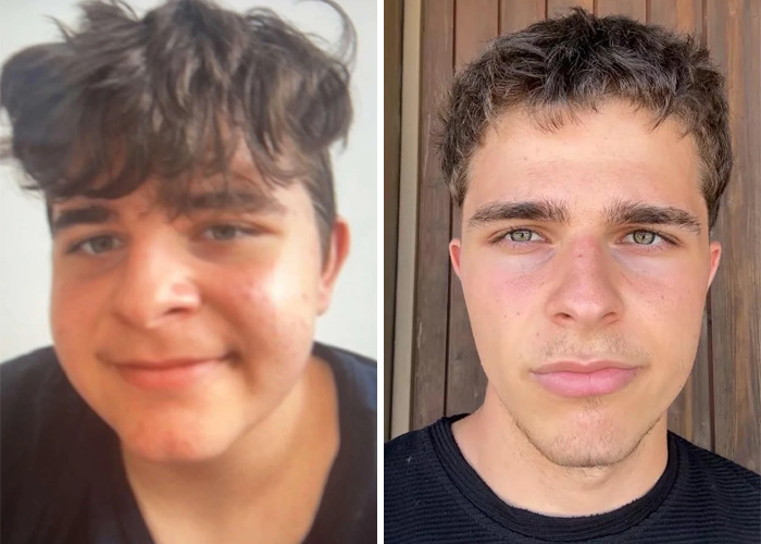 Side-by-side photos showing an inspiring ugly ducklings glow-up with a significant transformation in facial features and style.