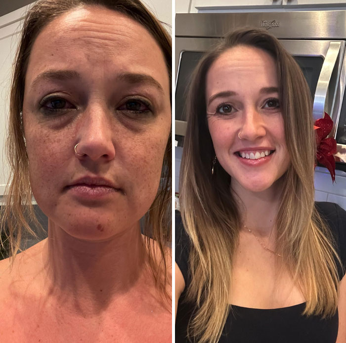 Transformación increíble de una mujer con cambio visible en su rostro, antes cansada y después sonriente y revitalizada.