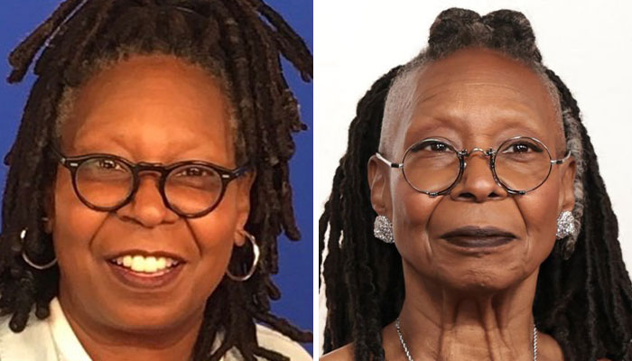 Side-by-side images showing a woman with glasses highlighting possible Ozempic side effect and drastic transformation.