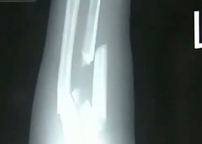 Woman Who Saved Little Girl Falling From 10th Floor Is Melting Hearts 14 Years Later