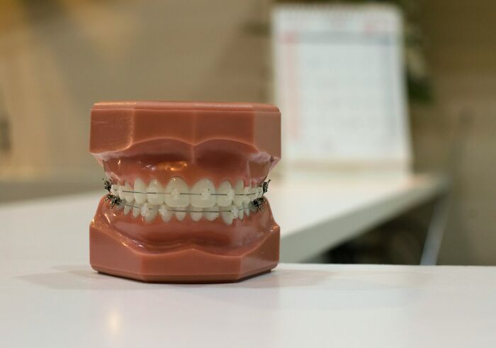 Dental model with braces on white teeth placed on a table illustrating something normal that would shock Americans
