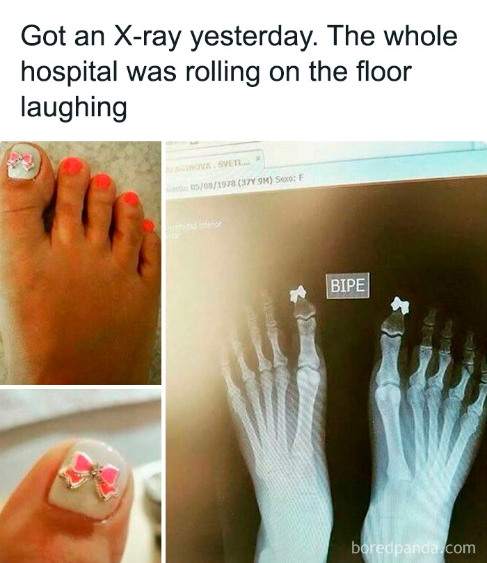 Foot with decorated toenails next to an X-ray showing bows on toes, a humorous medical meme about healthcare costs.