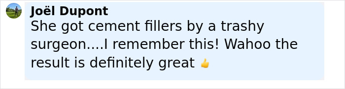 Comment praising a plastic surgeon who fixes botched operations, highlighting great results after cement filler correction.