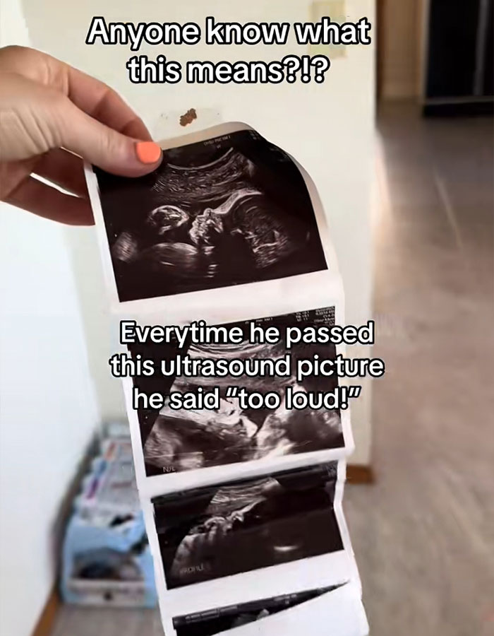 "Horror Movies Start Like This": Mom Stunned As 2YO Son Complains Ultrasound Photo Is &ldquo;Too Loud&rdquo;