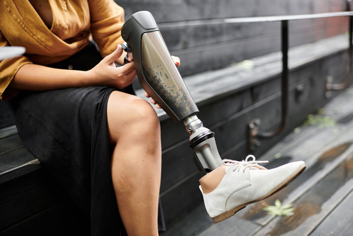 Girl with prosthetic leg sitting on outdoor bench, symbolizing survival and acceptance after cancer treatment.